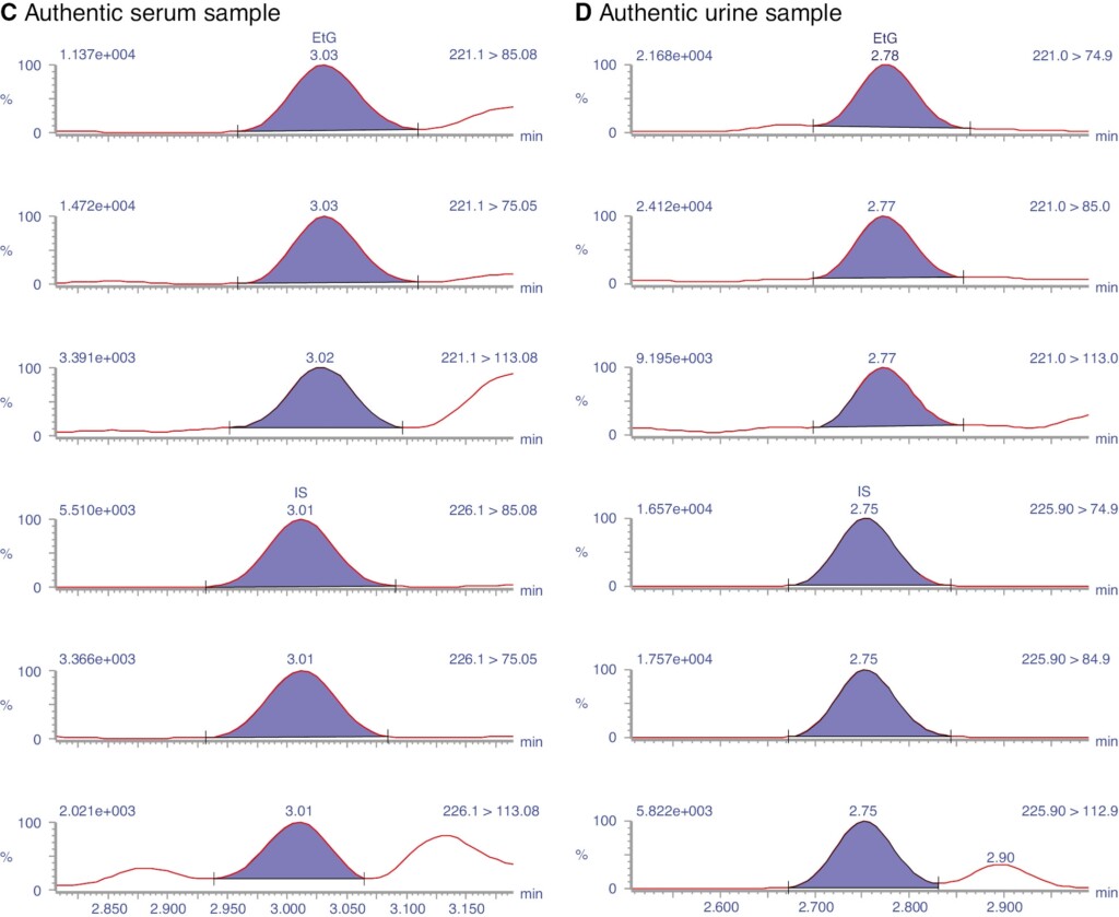 Sensitive Determination Of Ethyl Glucuronide In Serum And Whole Blood 
