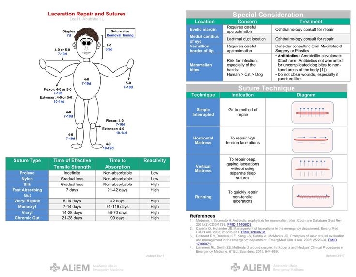 Suture Removal Times Chart